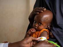 Two-year-old Mowlid eats a high protein peanut paste, also known as ready-to-use therapeutic food (RUTF), as treatment for his severe acute malnutrition. As part of our simplified approach, the IRC recommends providing RUTF as the primary treatment product for all children diagnosed with acute malnutrition.