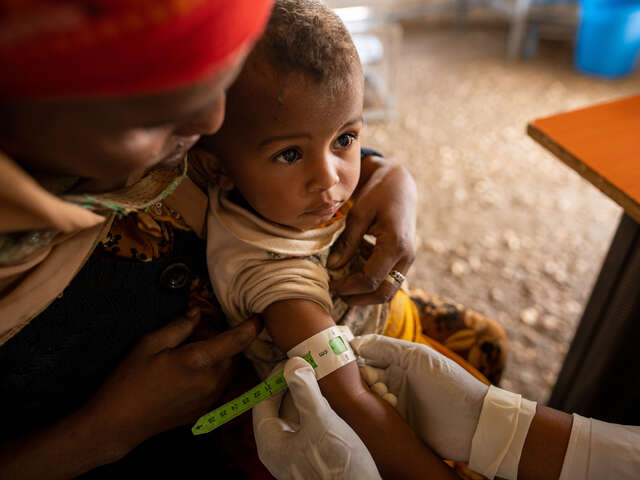 Ett litet barn undersöks för undernäring genom att få sin överarm mätt.