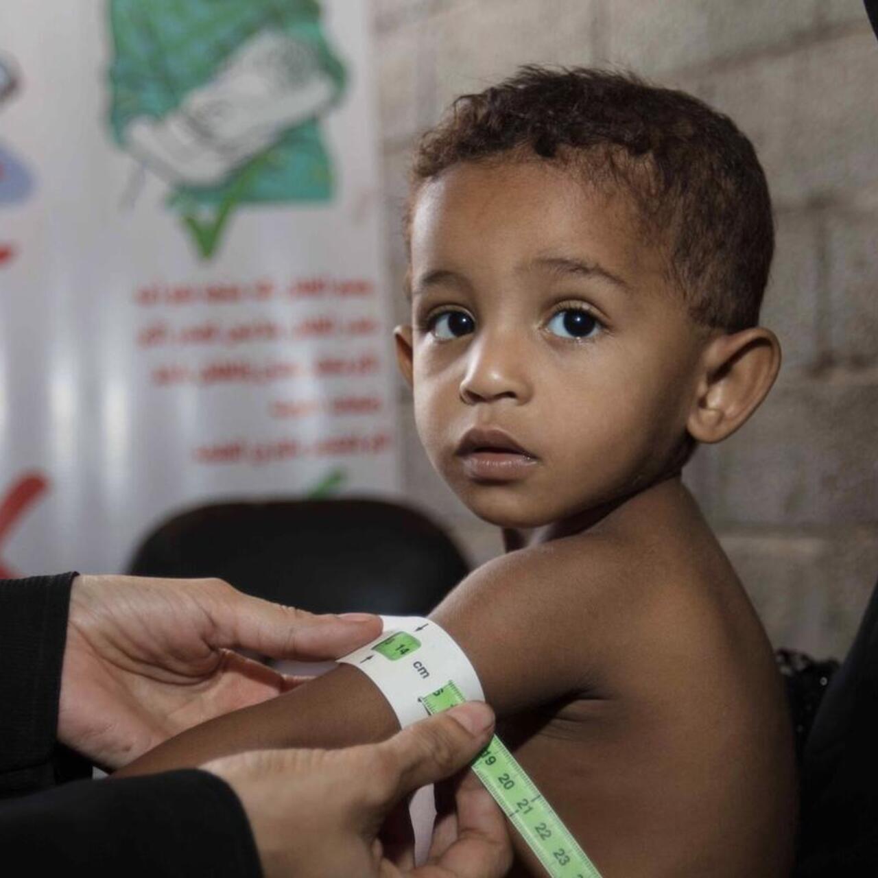 Ein Junge wird in einer mobilen IRC-Klinik in Jemen behandelt