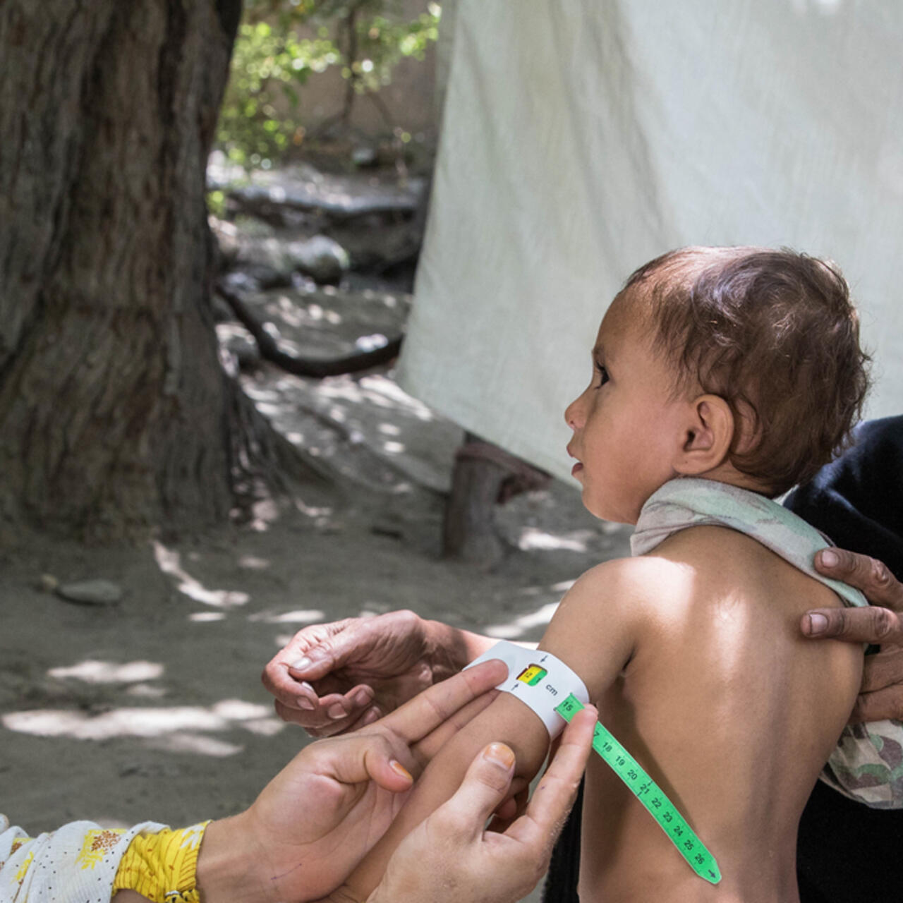 Riaz Bibi med hennes två barnbarn, Sema, 3 år, och Mazhda, 2 och ett halvt år. Hennes barnbarn Mazhda undersöks av näringsrådgivaren Marwa, med hjälp av ett MUAC-band, för att avgöra om han drabbats av undernäring.