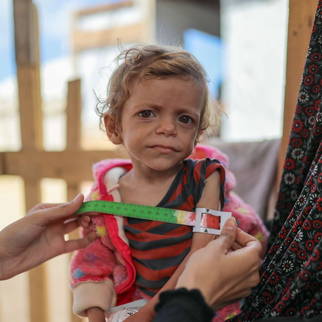 Ein junges Mädchen in Gaza wird auf Anzeichen von Unterernährung untersucht.