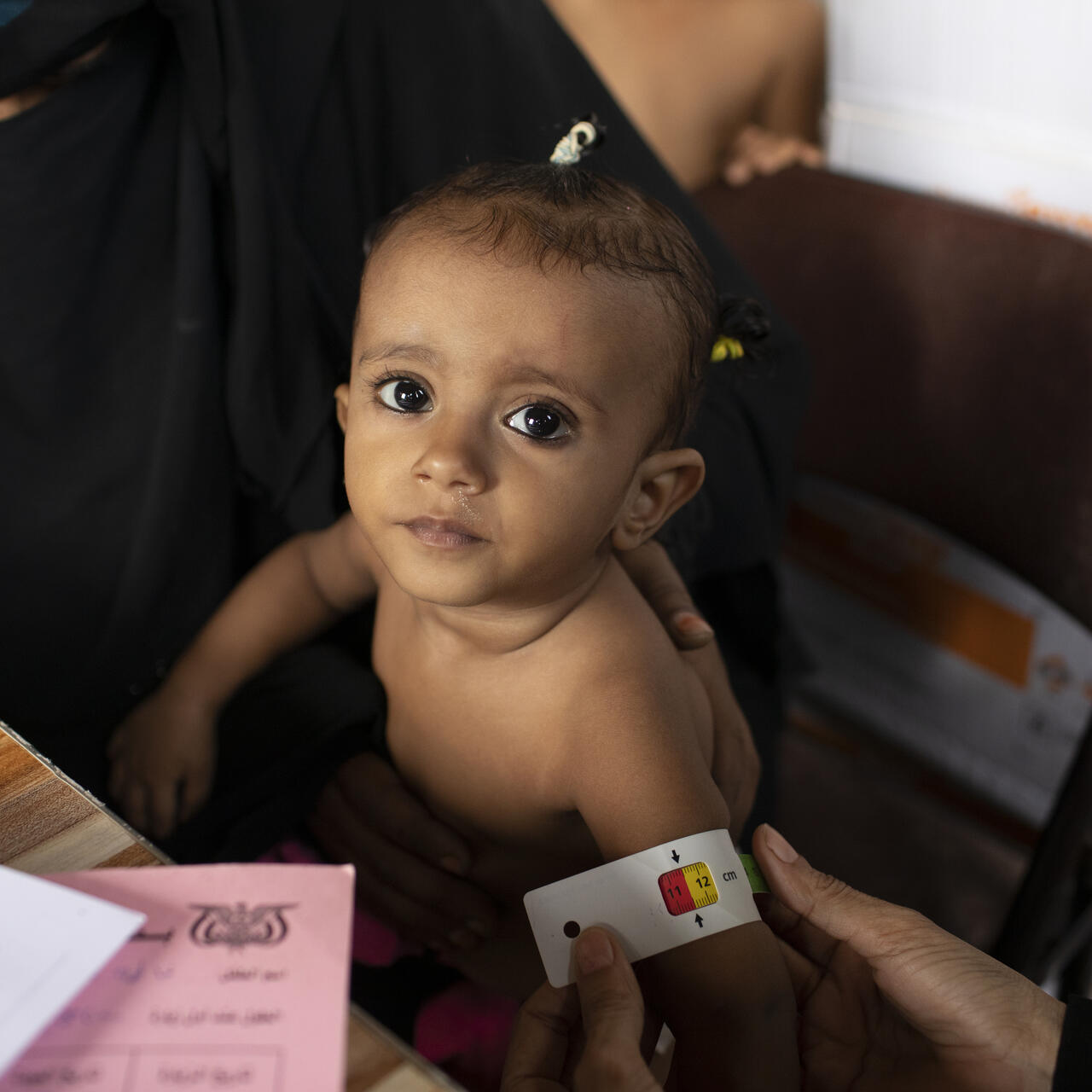 A small child being examined at an IRC clinic in Yemen has her upper arm measured with a MUAC tape, which shows she may be acutely malnourished.