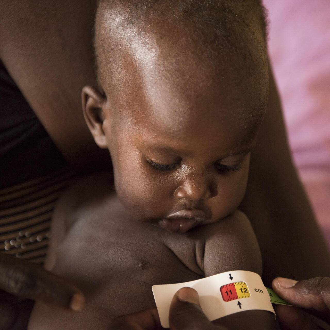 A health worker has placed a MUAC measuring tape around a South Sudanese baby's upper arm. The tape shows that he is at risk of acute malnutrition.
