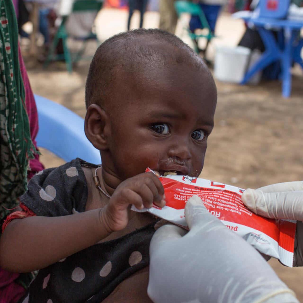 A toddler being treated for malnutrition eats a nutrient-rich peanut butter food