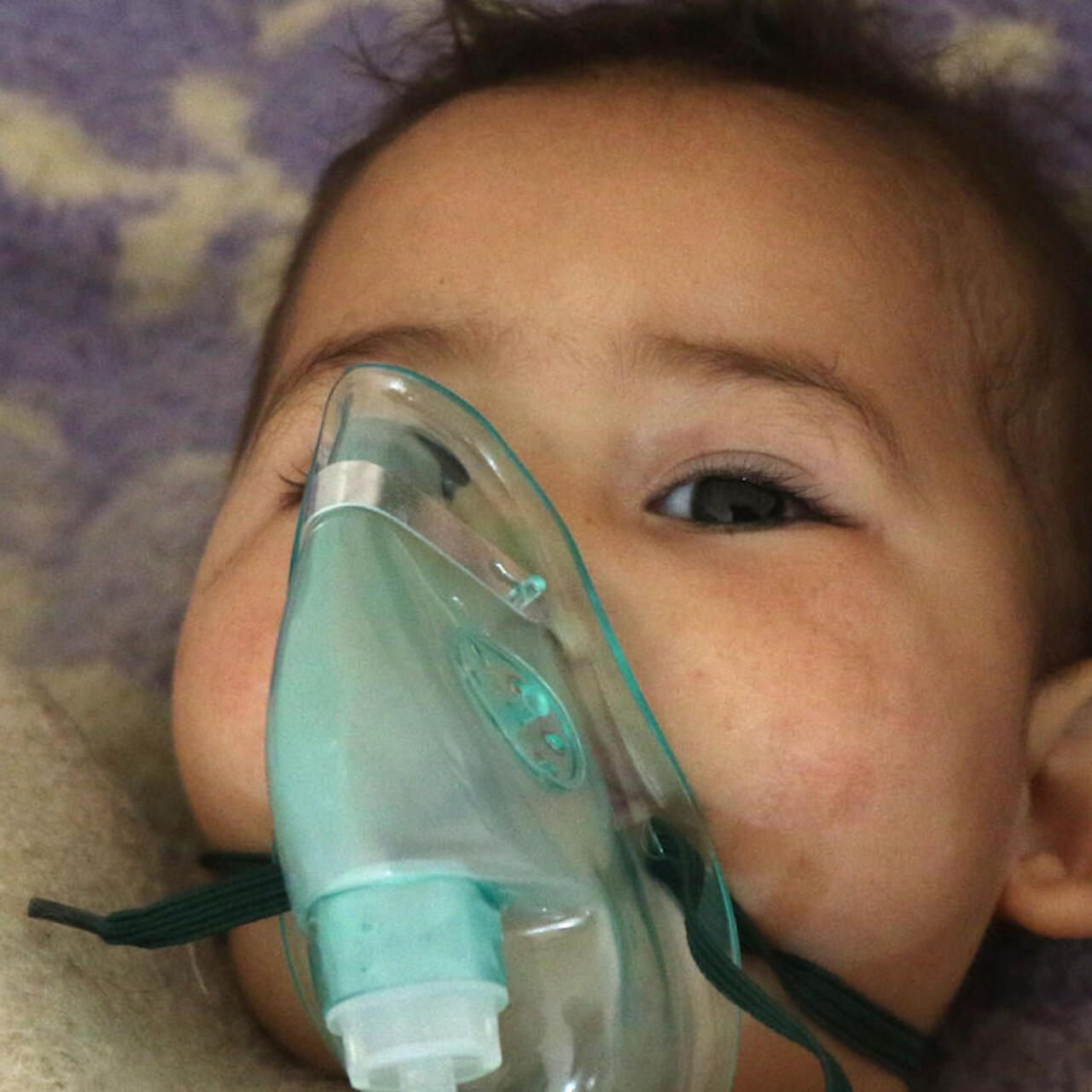 A baby injured in a chemical weapons attack in Idlib, Syria wears an oxygen mask while undergoing treatment