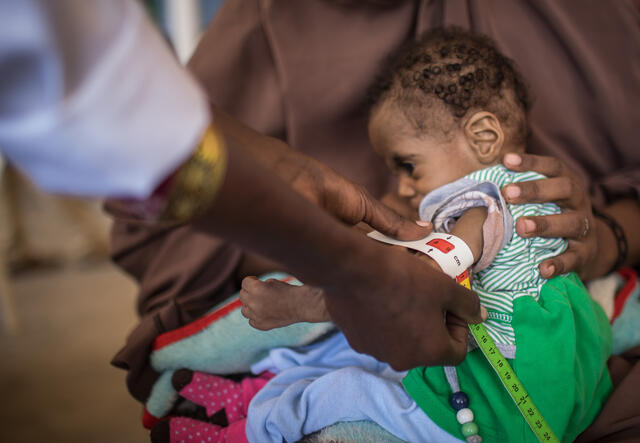 A 10-month-old girl is examined at one of the IRC clinics in Somalia that provide care for malnourished children.