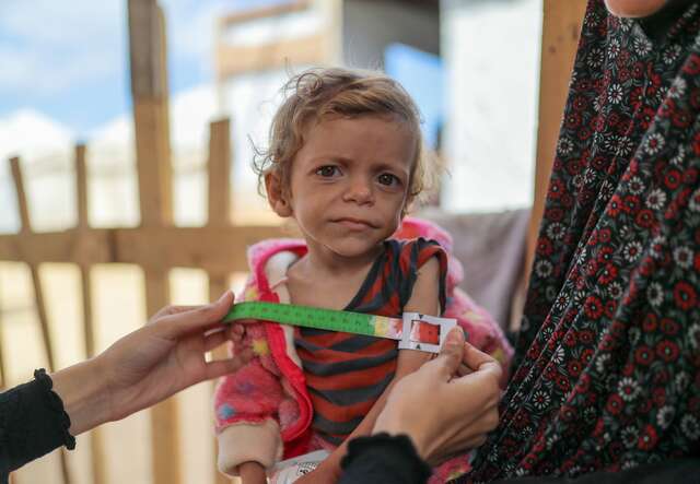 Ein junges Mädchen in Gaza wird auf Anzeichen von Unterernährung untersucht.