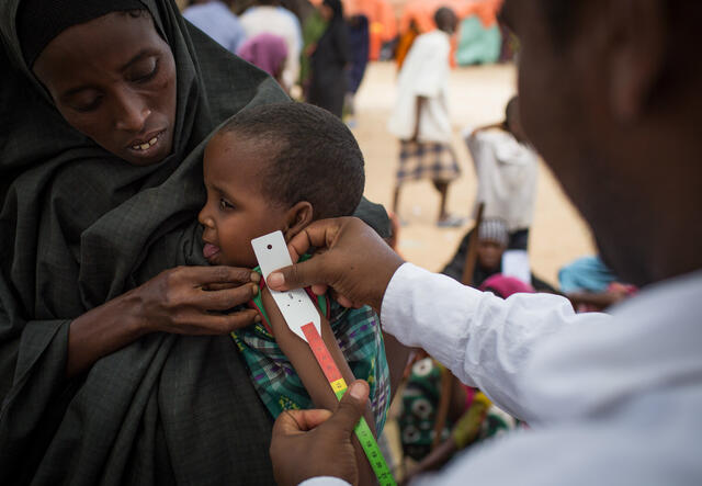 A health worker measures a child's arm for signs of malnutrition at a camp outside Mogadishu