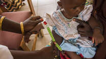 Six-month-year-old Falmata Usman with severe malnutrition